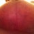 9 weeks Left T zone.  You can see scars are looking great and getting less red on them I think.  :)