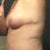 6.5 weeks PO