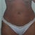 Abdomen 2 weeks post op Notice waist, too.