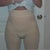 2 days post op with lovely girdle.