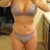 3 weeks post surgery/swelling on hips