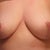 5 weeks post op.  They have dropped quite a lot.