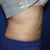5 months post