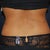 Back shot two months after lipo
