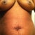 2 days before surgery