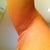 3 days later - right arm, side profile. to see the swollen pillowy affect