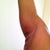 7 days later - right arm, side profile. still see swollen pillowy affect