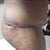 side view standing still swollen