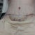 Day one - post op