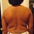 8 days before my surgery
