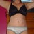 12 WEEKS POST OP