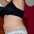 12 WEEKS POST OP
