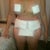 Day of my Surgery April 27