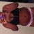 With a sports bra- Day 8- I try to wear the bras a little tight because of the swelling beside my breasts. Quite uncomfortable...