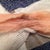 Another gross pic- This is how soaked the layers of gauze were each hour.- Day 9