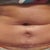 5weeks PO-no improvement but getting worst!