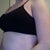 Two weeks, same top as before, which I hope to take pics in throughout my recovery to show how the size changes as they go.
