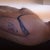Arms before Vaser