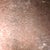 ok ladies you see how my belly button look it's driving me carzy I'm scare right now i don't kown what it is. It was looking perfect last week now it look like it's infected