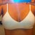 6 days post op-In Barely There Bra
