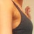 Side view in tank in underwire unpadded bra - pre surgery
