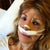 After - Hubby took this right after surgery.  I'm looking rather sleepy and unkempt!!