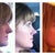0 - 2 Months - right profile.