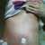 3 day po...I am hunched over and am wondering if my BB is too low?