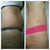 3wks po.  Before and after.