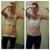 Before and 4wks post op.  Still have my muscles!  The scar is right under the very top of the pants.  The before photo shows the tattoo and the scar is right above that.