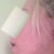 Here I've circled the hard, swollen lump under my chin. It is VERY noticeable from the sides.