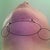 Post OP SIX Weeks: Arrows point to the "dimples" on either side of my chin and the circles indicate all the swelling still present under chin and along jaw line.