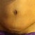 Scar and belly button up close. Took this pic last night when I was swollen.