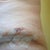 POD9, another view of left hip with bulge/bruise, doubt its swelling as too big!!