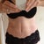 2 weeks post op