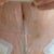 My T junction as had a fleur de lis. 2 weeks PO.