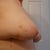 From right side; doctor said this one is "hung up" a little bit.