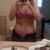 2 years post op