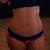 2 months after smart lipo