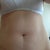 Before pic of tummy - may look better than it is