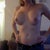 3 weeks post op
