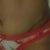 This view shows my very high scar on my right side and my dog ear on the other side!