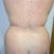before 2-16-11 back view