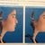 Simulated before n after