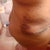 swole n bruised