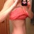 24 Days Postop - Just a little swelling above the incision on this side.