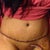 Swelling puffy