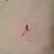 Stitch that came out of my BB at 4 weeks.