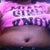 Letting the belly breath I love the binder but I like to let it out is relieving still swollen and fluidly  4 days after surgery not bad at all!