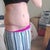 POD 17. Have no tried jeans yet, still very swollen.